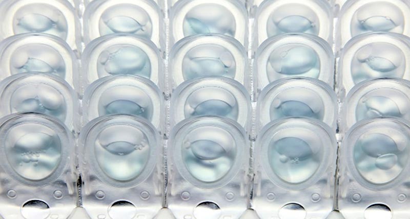 contact lenses adult pediatric eyecare local eye doctor near you contact lenses adult pediatric eyecare local eye doctor near you